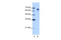 Anti-DDX17 Rabbit Polyclonal Antibody