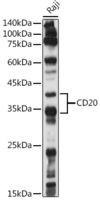Anti-CD20 Rabbit Polyclonal Antibody