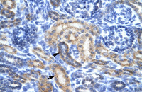 Anti-OR13C9 Rabbit Polyclonal Antibody