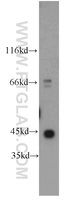 Anti-gamma Actin Rabbit Polyclonal Antibody