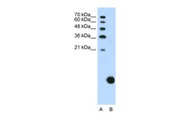 Anti-RPS29 Rabbit Polyclonal Antibody