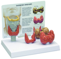 GPI Anatomicals® Thyroid Model