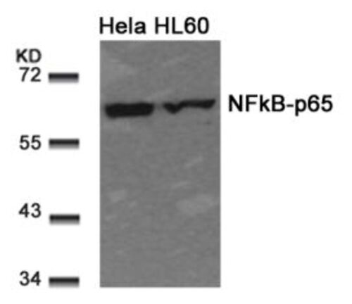 NFkB p65 (Ab 311) Antibody