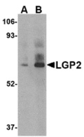 Anti-DHX58 Rabbit Polyclonal Antibody