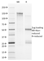 Anti-CD20 Mouse Monoclonal Antibody [clone: B9E9]