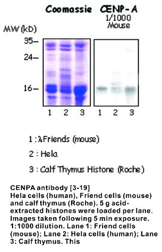 Mouse Monoclonal antibody to CENPA (centromere protein A)