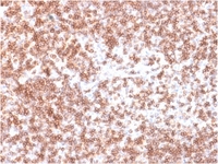 Anti-CD45 Rabbit Recombinant Antibody [clone: PTPRC/1975R]