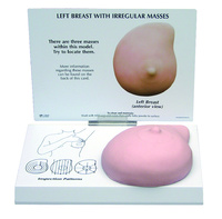 GPI Anatomicals® Left Breast With Irregular Masses Model