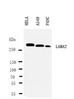 Anti-LAMA2 Rabbit Polyclonal Antibody