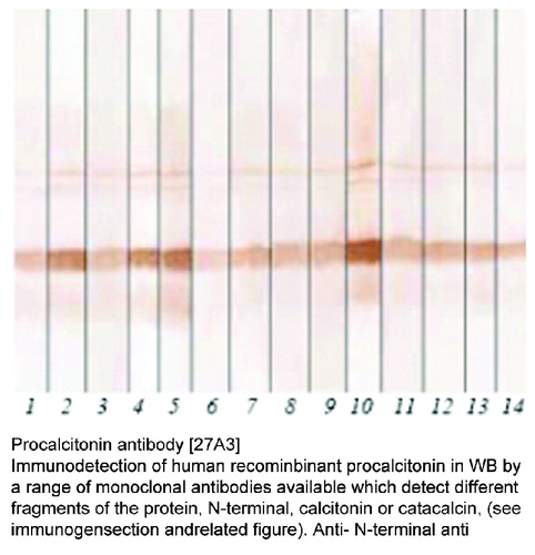 Mouse Monoclonal antibody to Procalcitonin (calcitonin-related polypeptide alpha)