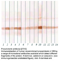Anti-CALCA Mouse Monoclonal Antibody [clone: 27A3]