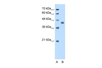 Anti-PDHA1 Rabbit Polyclonal Antibody