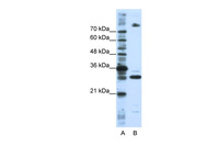 Anti-SRSF10 Rabbit Polyclonal Antibody