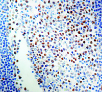 Anti-Retinoblastoma Mouse Monoclonal Antibody [clone: 1F8]