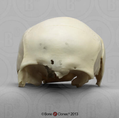 Human Female Partial Cranium Skull model 17.9L x 13.3W x 10.2H (cm)