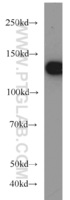 Anti-DHX9 Rabbit Polyclonal Antibody