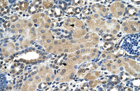 Anti-ASPH Rabbit Polyclonal Antibody