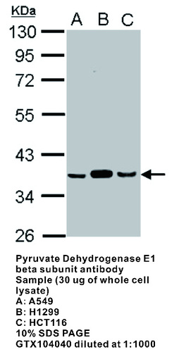 Rabbit Polyclonal antibody to Pyruvate Dehydrogenase E1 beta subunit