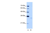 Anti-EXOSC6 Rabbit Polyclonal Antibody