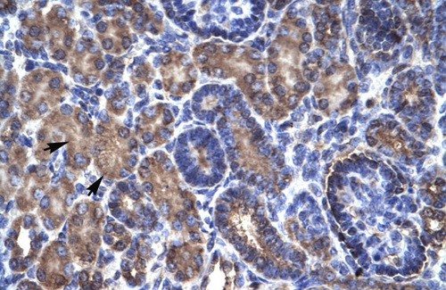 PSMD11 Antibody