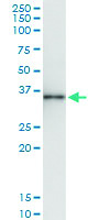 Anti-ALKBH3 Polyclonal Antibody Pair