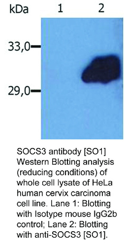 Mouse Monoclonal antibody to SOCS3 (suppressor of cytokine signaling 3)