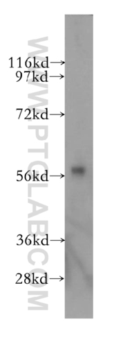 Anti-CYP46A1