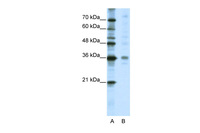 Anti-MED27 Rabbit Polyclonal Antibody