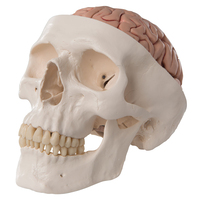3B Scientific® Skull With 5 Part Brain