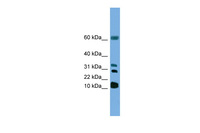 Anti-LTC4S Rabbit Polyclonal Antibody
