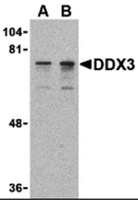 Anti-DDX3X Rabbit Polyclonal Antibody