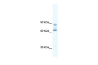 Anti-DDX42 Rabbit Polyclonal Antibody