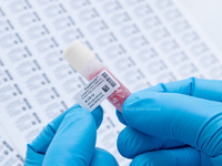 Cryogenic Laser Labels for Frozen Vials and Containers