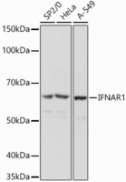 Anti-Interferon alpha/beta receptor 1 Rabbit Polyclonal Antibody