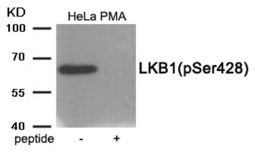 LKB1 (phospho Ser428) Polyclonal Antibody 0.1mg