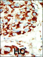 Anti-PRKAB1 Rabbit Polyclonal Antibody