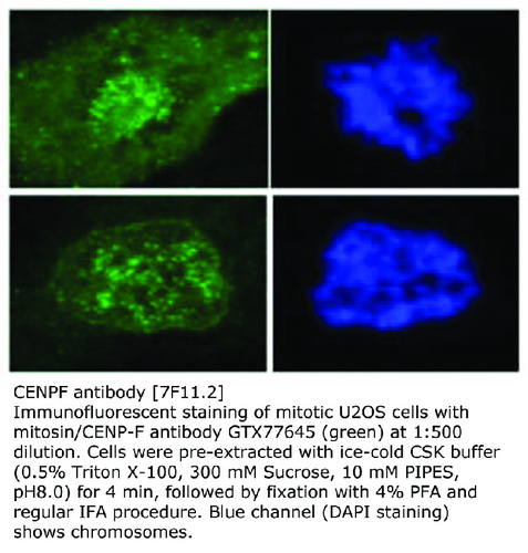 Mouse Monoclonal antibody to Mitosin (centromere protein F, 350/400kDa (mitosin))