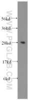Anti-LIN28 Rabbit Polyclonal Antibody
