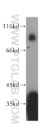 Anti-NFE2L3 Rabbit Polyclonal Antibody