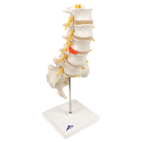 3B Scientific® Lumbar Spinal Column With Prolapsed Disc
