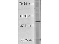 Anti-RHO Mouse Monoclonal Antibody [clone: 1D4]