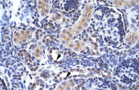 Anti-TAF1 Rabbit Polyclonal Antibody