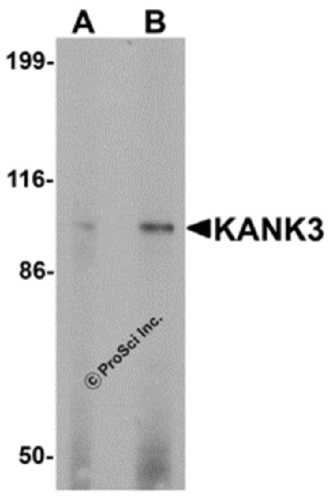 KANK3 antibody