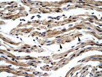 Anti-GTF2E1 Rabbit Polyclonal Antibody