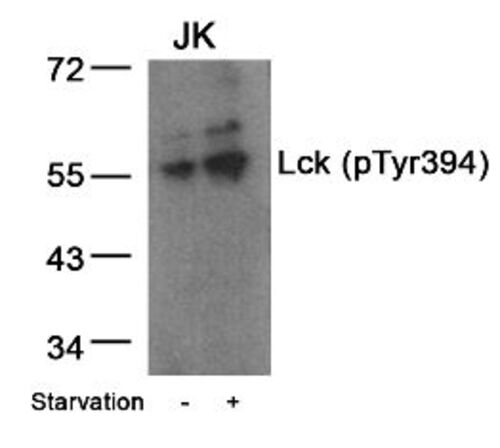 Lck (phospho Tyr394) Antibody