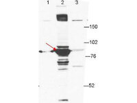 Anti-ESRP1 Mouse Monoclonal Antibody [clone: 27H12]