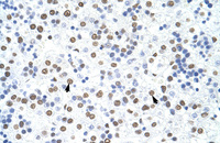 Anti-HNRNPD Rabbit Polyclonal Antibody