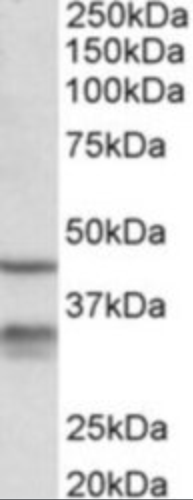Hsd11b1 Antibody