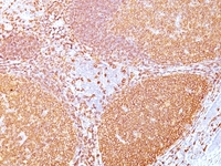 Anti-CD20 Mouse Monoclonal Antibody [clone: IGEL/773]