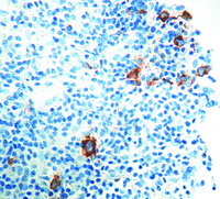 Anti-Ki1 (CD30) Mouse Monoclonal Antibody [clone: Ber-H2]